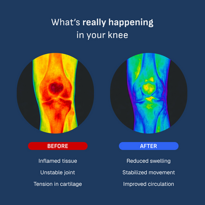 Smart Knee Brace